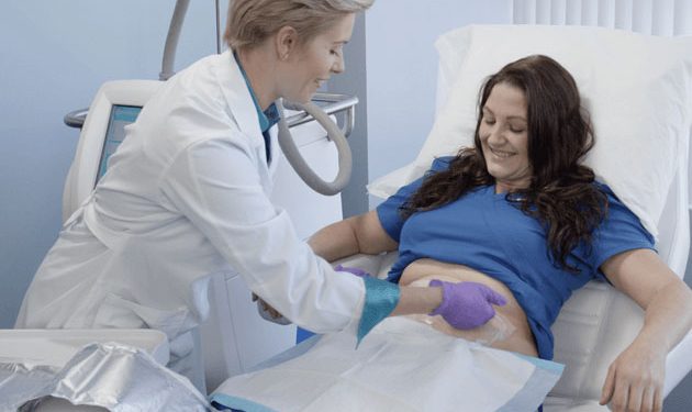 coolsculpting in toronto