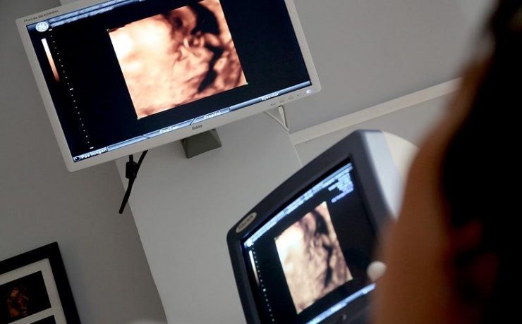 How To Choose The Right Ultrasound Equipment For My Practice