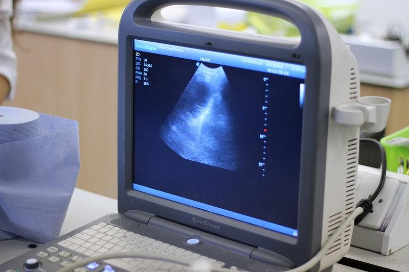 How To Choose The Right Ultrasound Equipment For My Practice
