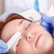 How to Get a Blepharoplasty Covered By Insurance