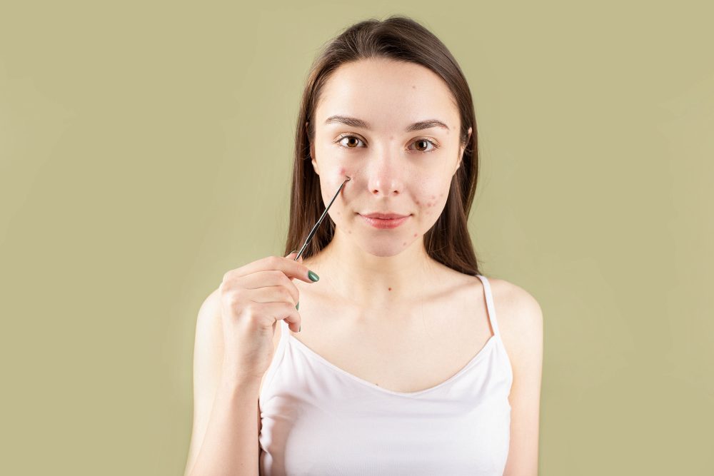Skin Conditions 101: What You Need to Know